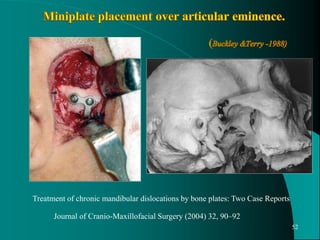 Treatment of chronic mandibular dislocations by bone plates: Two Case Reports
Journal of Cranio-Maxillofacial Surgery (2004) 32, 90–92
52
 