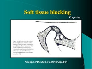 Fixation of the disc in anterior position
Konjetzny
53
 