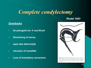 Drawbacks
• lat pterygoid ms  sacrificed
• Shortening of ramus,
• open bite deformity&
• retrusion of mandible
• Loss of translatory movement.
Riedel 1883
59
 