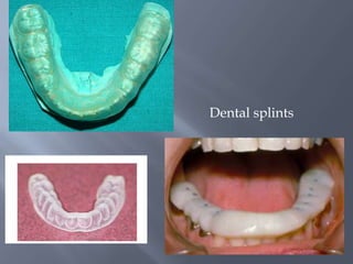 Dental splints
 