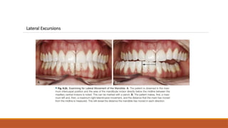 TMJ DISORDERS IN ORTHODONTICS as require | PPTX