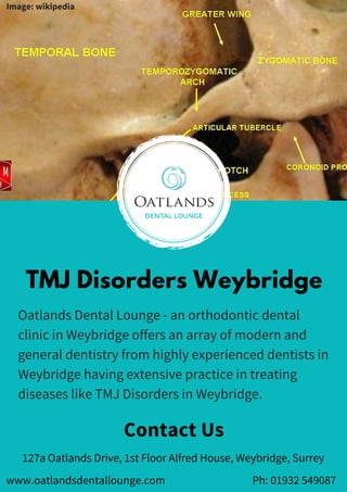 TMJ Disorders Weybridge
Contact Us
Oatlands Dental Lounge - an orthodontic dental
clinic in Weybridge offers an array of modern and
general dentistry from highly experienced dentists in
Weybridge having extensive practice in treating
diseases like TMJ Disorders in Weybridge.
www.oatlandsdentallounge.com Ph: 01932 549087
127a Oatlands Drive, 1st Floor Alfred House, Weybridge, Surrey
Image: wikipedia
 