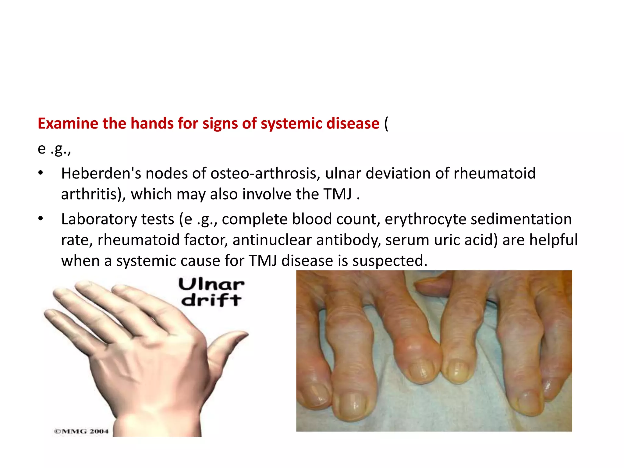 Tmj examination & imaging | PPTX