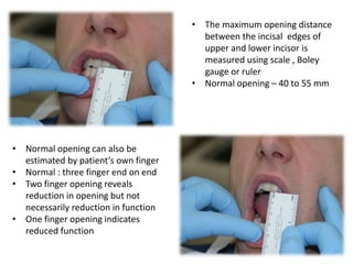 Tmj Paper Ruler Tmj examination & imaging | PPTX