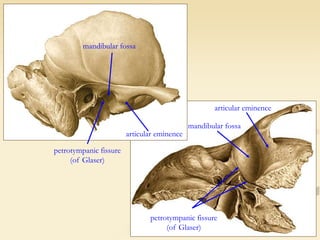 mandibular fossa
articular eminence
petrotympanic fissure
(of Glaser)
articular eminence
mandibular fossa
petrotympanic fissure
(of Glaser)
 