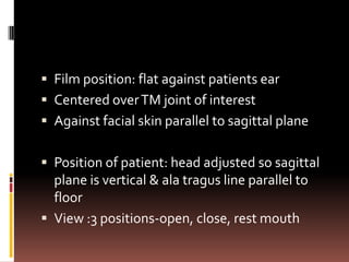  Film position: flat against patients ear
 Centered over TM joint of interest
 Against facial skin parallel to sagittal plane


 Position of patient: head adjusted so sagittal
  plane is vertical & ala tragus line parallel to
  floor
 View :3 positions-open, close, rest mouth
 