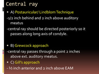 Central ray
 A) Postauricular/ Lindblom Technique
-1/2 inch behind and 2 inch above auditory
  meatus
-central ray should be directed posteriorly so it
  passes along long axis of condyle.

 B) Grewcock approach
-central ray passes through a point 2 inches
  above ext. auditory meatus.
 C) Gill’s approach
- ½ inch anterior and 2 inch above EAM
 