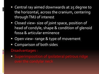  Central ray aimed downwards at 25 degree to
  the horizontal, across the cranium, centering
  through TMJ of interest
 Closed view- size of joint space, position of
  head of condyle, shape & condition of glenoid
  fossa & articular eminence
 Open view- range & type of movement
 Comparison of both sides
Disadvantages :
 Superimposition of ipsilateral petrous ridge
  over the condylar neck
 