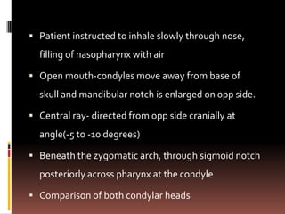 Patient instructed to inhale slowly through nose,
  filling of nasopharynx with air

 Open mouth-condyles move away from base of
  skull and mandibular notch is enlarged on opp side.

 Central ray- directed from opp side cranially at
  angle(-5 to -10 degrees)

 Beneath the zygomatic arch, through sigmoid notch
  posteriorly across pharynx at the condyle

 Comparison of both condylar heads
 