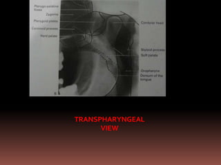 TRANSPHARYNGEAL
      VIEW
 
