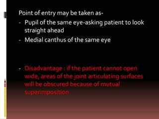 Point of entry may be taken as-
- Pupil of the same eye-asking patient to look
  straight ahead
- Medial canthus of the same eye



- Disadvantage : if the patient cannot open
  wide, areas of the joint articulating surfaces
  will be obscured because of mutual
  superimposition
 
