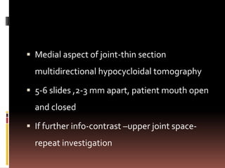  Medial aspect of joint-thin section
  multidirectional hypocycloidal tomography

 5-6 slides ,2-3 mm apart, patient mouth open
  and closed

 If further info-contrast –upper joint space-
  repeat investigation
 