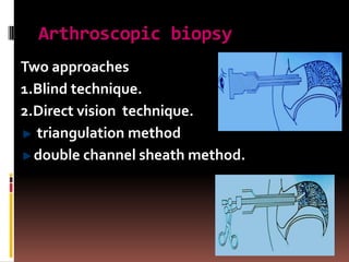 Arthroscopic biopsy
Two approaches
1.Blind technique.
2.Direct vision technique.
  triangulation method
  double channel sheath method.
 