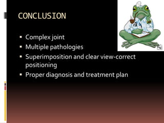 CONCLUSION

 Complex joint
 Multiple pathologies
 Superimposition and clear view-correct
  positioning
 Proper diagnosis and treatment plan
 