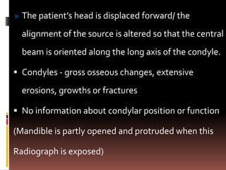 The patient’s head is displaced forward/ the
  alignment of the source is altered so that the central
  beam is oriented along the long axis of the condyle.

 Condyles - gross osseous changes, extensive

  erosions, growths or fractures

 No information about condylar position or function

(Mandible is partly opened and protruded when this

Radiograph is exposed)
 