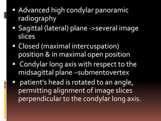  Advanced high condylar panoramic
    radiography
   Sagittal (lateral) plane ->several image
    slices
   Closed (maximal intercuspation)
    position & in maximal open position
   Condylar long axis with respect to the
    midsagittal plane –submentovertex
    patient's head is rotated to an angle,
    permitting alignment of image slices
    perpendicular to the condylar long axis.
 