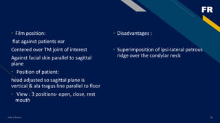 Petrous Ridge Positioning Chart T mj imaging | PPTX
