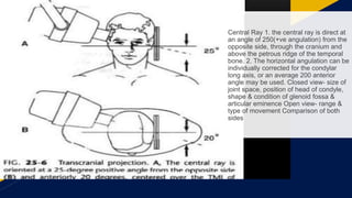 Petrous Ridge Positioning Chart T mj imaging | PPTX