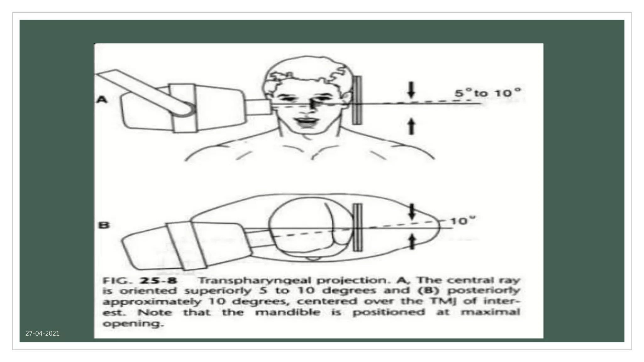 Tmj Radiograph Positioning Tmj imaging | PPTX
