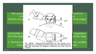 Petrous Ridge Positioning Chart Tmj imaging | PPTX
