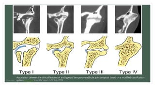 Tmj imaging | PPTX