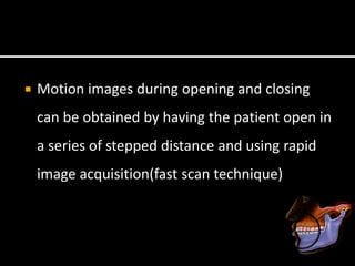  Motion images during opening and closing
can be obtained by having the patient open in
a series of stepped distance and using rapid
image acquisition(fast scan technique)
 