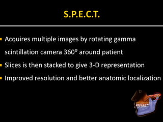  Acquires multiple images by rotating gamma
scintillation camera 360⁰ around patient
 Slices is then stacked to give 3-D representation
 Improved resolution and better anatomic localization
 