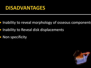  Inability to reveal morphology of osseous components
 Inability to Reveal disk displacements
 Non specificity
 