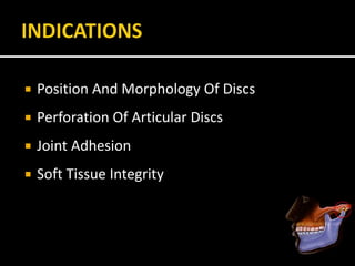 Position And Morphology Of Discs
 Perforation Of Articular Discs
 Joint Adhesion
 Soft Tissue Integrity
 
