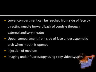  Lower compartment can be reached from side of face by
directing needle forward back of condyle through
external auditory meatus
 Upper compartment from side of face under zygomatic
arch when mouth is opened
 Injection of medium
 Imaging under fluoroscopy using x ray video system
 
