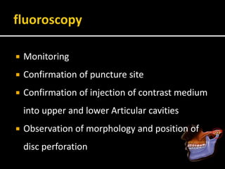  Monitoring
 Confirmation of puncture site
 Confirmation of injection of contrast medium
into upper and lower Articular cavities
 Observation of morphology and position of
disc perforation
 