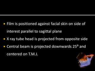 Film is positioned against facial skin on side of
interest parallel to sagittal plane
 X ray tube head is projected from opposite side
 Central beam is projected downwards 25⁰ and
centered on T.M.J.
 