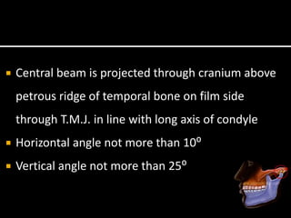  Central beam is projected through cranium above
petrous ridge of temporal bone on film side
through T.M.J. in line with long axis of condyle
 Horizontal angle not more than 10⁰
 Vertical angle not more than 25⁰
 