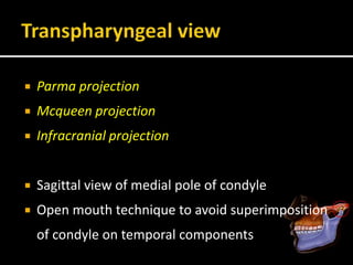  Parma projection
 Mcqueen projection
 Infracranial projection
 Sagittal view of medial pole of condyle
 Open mouth technique to avoid superimposition
of condyle on temporal components
 