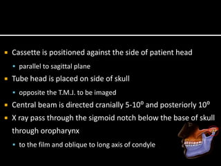  Cassette is positioned against the side of patient head
 parallel to sagittal plane
 Tube head is placed on side of skull
 opposite the T.M.J. to be imaged
 Central beam is directed cranially 5-10⁰ and posteriorly 10⁰
 X ray pass through the sigmoid notch below the base of skull
through oropharynx
 to the film and oblique to long axis of condyle
 