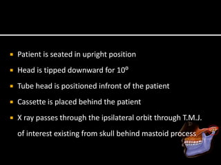  Patient is seated in upright position
 Head is tipped downward for 10⁰
 Tube head is positioned infront of the patient
 Cassette is placed behind the patient
 X ray passes through the ipsilateral orbit through T.M.J.
of interest existing from skull behind mastoid process
 
