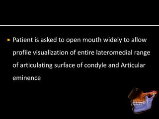  Patient is asked to open mouth widely to allow
profile visualization of entire lateromedial range
of articulating surface of condyle and Articular
eminence
 