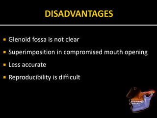  Glenoid fossa is not clear
 Superimposition in compromised mouth opening
 Less accurate
 Reproducibility is difficult
 