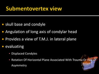  skull base and condyle
 Angulation of long axis of condylar head
 Provides a view of T.M.J. in lateral plane
 evaluating
▪ Displaced Condyles
▪ Rotation Of Horizontal Plane Associated With Trauma Or Facial
Asymmetry
 