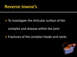  To investigate the Articular surface of the
condyles and disease within the joint
 Fractures of the condylar heads and necks
 