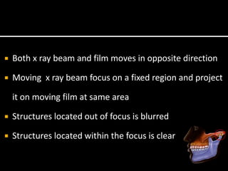  Both x ray beam and film moves in opposite direction
 Moving x ray beam focus on a fixed region and project
it on moving film at same area
 Structures located out of focus is blurred
 Structures located within the focus is clear
 