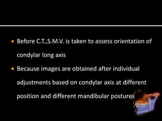  Before C.T.,S.M.V. is taken to assess orientation of
condylar long axis
 Because images are obtained after individual
adjustments based on condylar axis at different
position and different mandibular postures
 