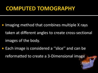  Imaging method that combines multiple X rays
taken at different angles to create cross-sectional
images of the body.
 Each image is considered a ‘‘slice’’ and can be
reformatted to create a 3-Dimensional image
 