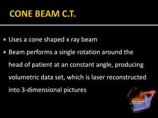  Uses a cone shaped x ray beam
 Beam performs a single rotation around the
head of patient at an constant angle, producing
volumetric data set, which is laser reconstructed
into 3-dimensional pictures
 