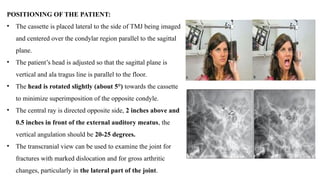Tmj Radiograph Positioning Temporomandibular joint imaging modalities | PPTX