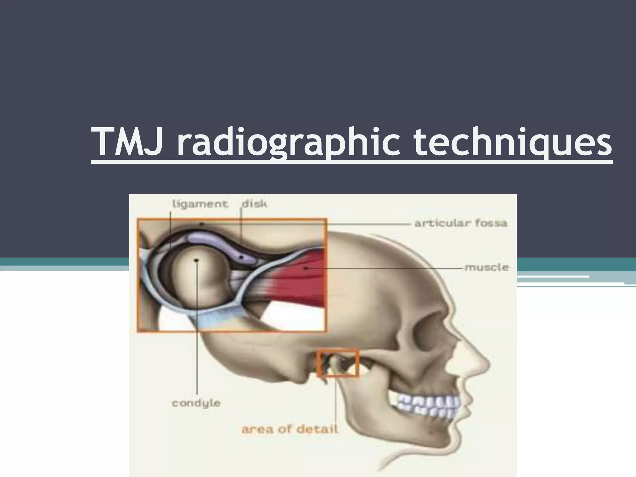 Tmj Radiograph Positioning Tmj imaging techniques | PPTX