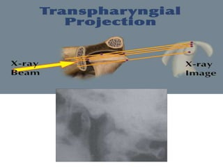 Tmj imaging techniques | PPTX