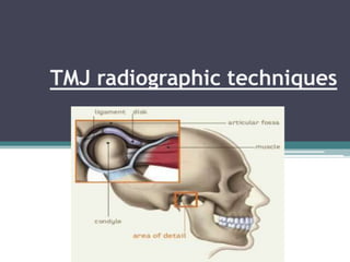 TMJ radiographic techniques
 