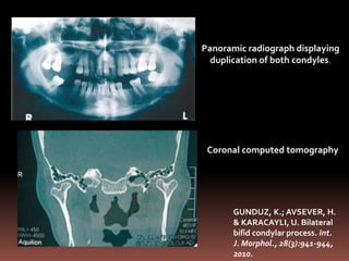 Tmj joint imaging | PPTX