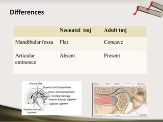 Differences 
Neonatal tmj Adult tmj 
Mandibular fossa Flat Concave 
Articular 
eminence 
Absent Present 
 